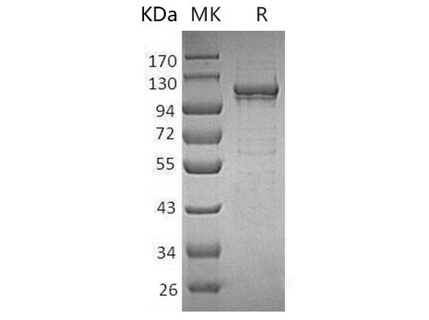 Human MANSC1 Recombinant Protein (RPES4304)