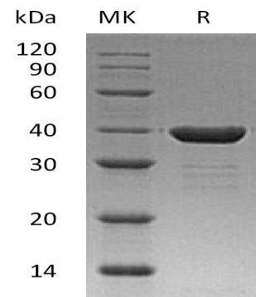 Carbonic Anhydrase 8/CA8 Recombinant Protein (RPES4327)