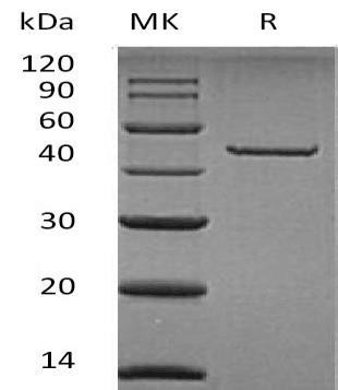Carboxypeptidase A2/CPA2 Recombinant Protein (RPES4422)