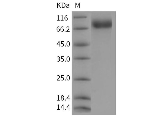 Rat c-KIT/CD117 Recombinant Protein (His Tag) (RPES4459)