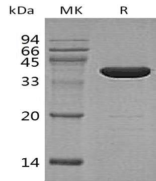 Human GABA Recombinant Protein (RPES4487)
