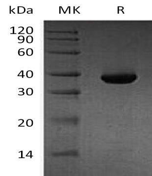 Human MAP1D Recombinant Protein (RPES4531)