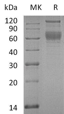 Human SerpinA4/SERPINA4 Recombinant Protein (RPES4555)