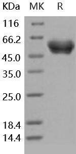 Human SerpinA1/A1AT Recombinant Protein (RPES4565)