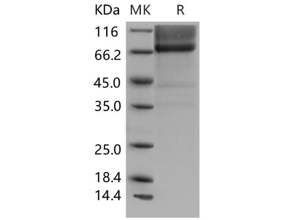 Mouse Biglycan/BGN Recombinant Protein (Fc Tag) (RPES4649)