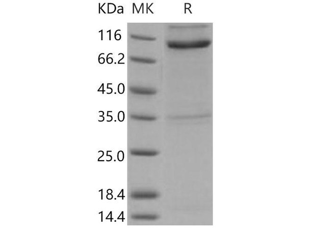 Mouse Nogo Receptor/NgR Recombinant Protein (His & Fc Tag) (Active) (RPES4712)