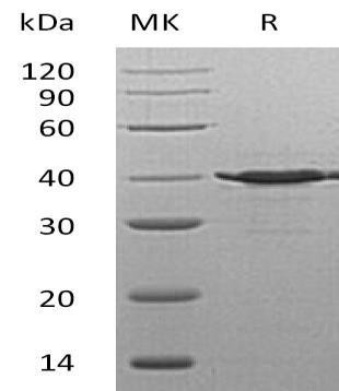 Human TSTA3/SDR4E1 Recombinant Protein (RPES4844)