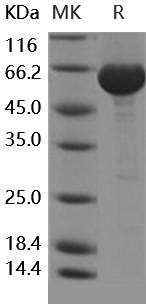 Human LTA4H Recombinant Protein (RPES4879)