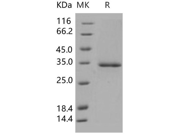 Human Ficolin/Ficolin-A/FCN1 Recombinant Protein (His Tag) (Active) (RPES5059)