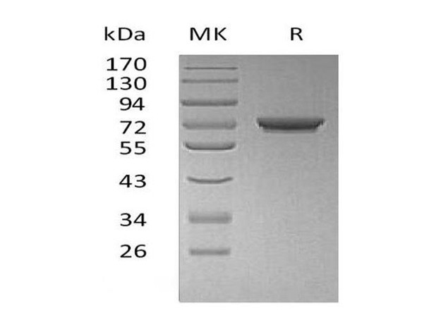 Human GALNT7 Recombinant Protein (RPES5087)