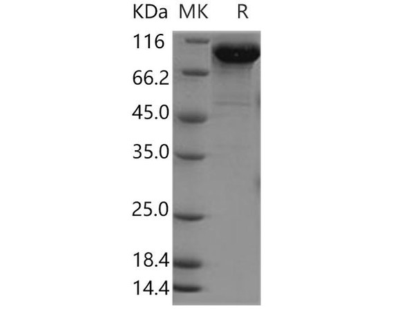 Human FSTL5 Recombinant Protein (His Tag) (RPES5154)