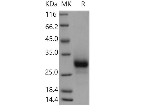 Human TNFRSF19/TROY Recombinant Protein (RPES5174)