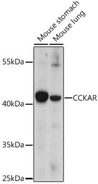 CCKAR Rabbit Polyclonal Antibody (CAB16799)
