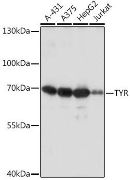 TYR Rabbit Polyclonal Antibody (CAB16993)