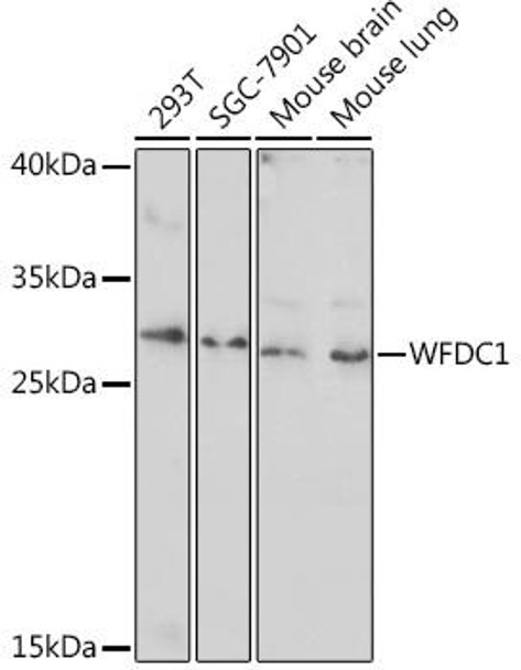WFDC1 Rabbit Polyclonal Antibody (CAB17193)