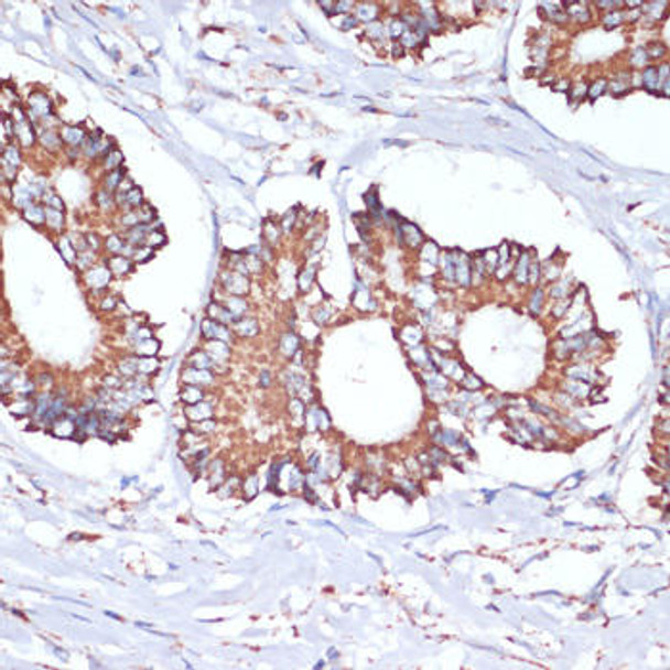 UBE2O Rabbit Polyclonal Antibody (CAB17201)