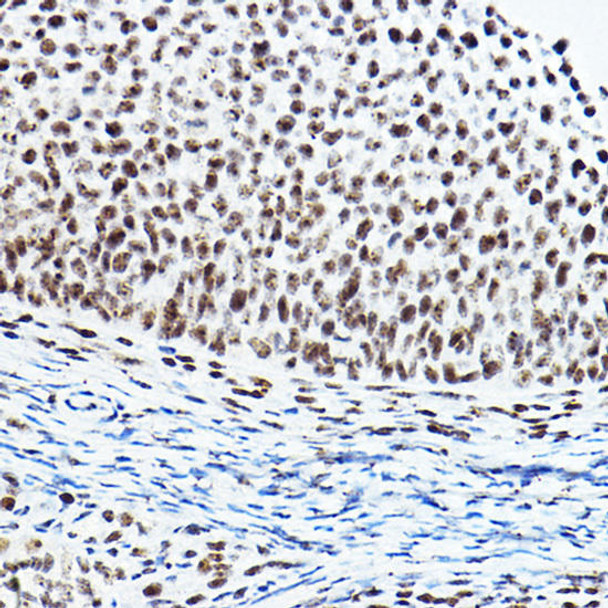 PAXIP1 Rabbit Polyclonal Antibody (CAB17431)