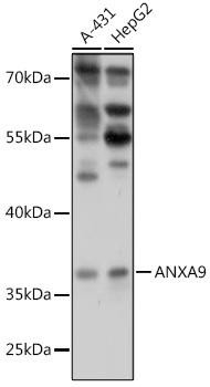 ANXA9 Rabbit Polyclonal Antibody (CAB17566)