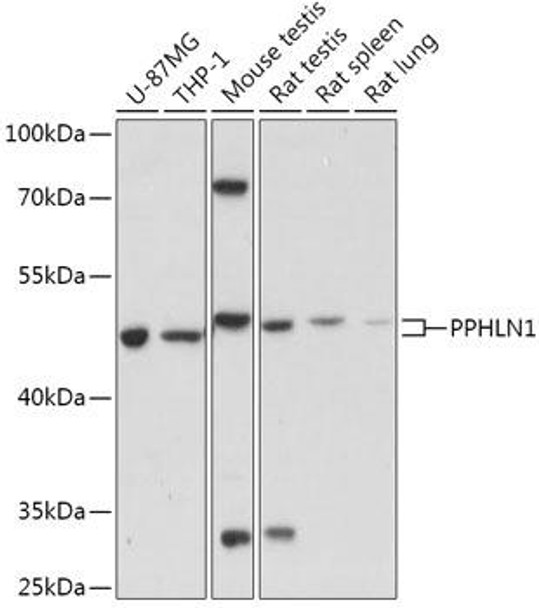 PPHLN1 Rabbit Polyclonal Antibody (CAB17706)