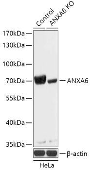 [KO Validated] ANXA6 Rabbit Polyclonal Antibody (CAB18069)