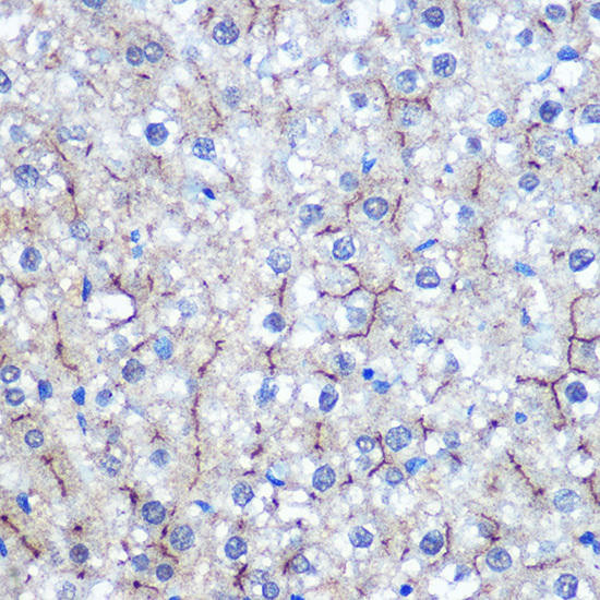 HILPDA Rabbit Polyclonal Antibody (CAB18221)