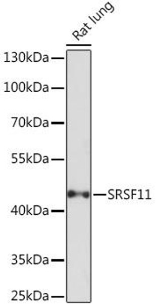 SRSF11 Rabbit Polyclonal Antibody (CAB18404)