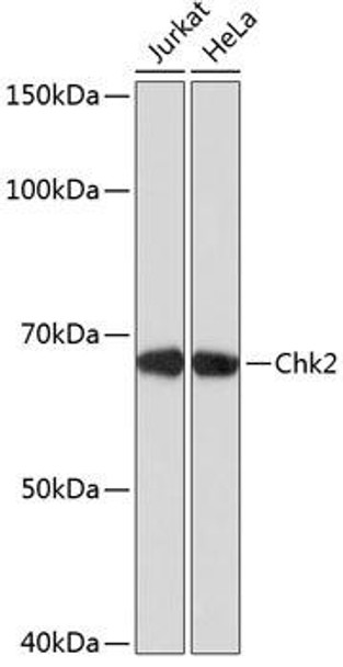 Chk2 Rabbit Monoclonal Antibody (CAB19543)