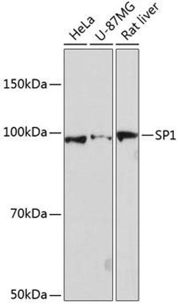 SP1 Rabbit Monoclonal Antibody (CAB19649)
