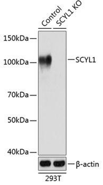 [KO Validated] SCYL1 Rabbit Polyclonal Antibody (CAB19913)
