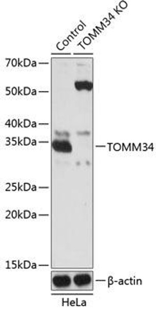 [KO Validated] TOMM34 Rabbit Polyclonal Antibody (CAB19960)