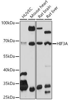HIF3A Rabbit Polyclonal Antibody (CAB20020)