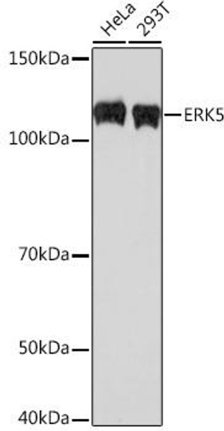 ERK5 Rabbit Monoclonal Antibody (CAB3948)