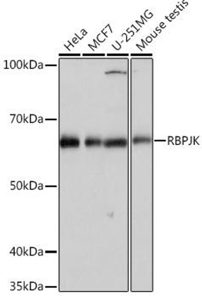 RBPJK Rabbit Monoclonal Antibody (CAB4081)