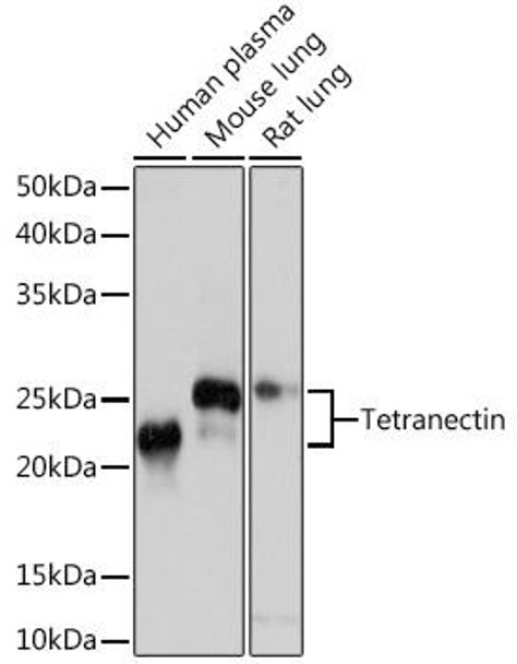 CLEC3B/Tetranectin Rabbit Monoclonal Antibody (CAB4387)