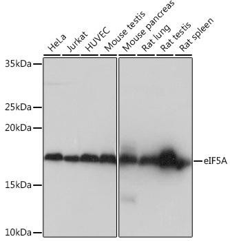 eIF5A Rabbit Monoclonal Antibody (CAB4414)