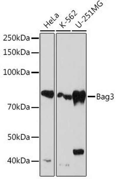 BAG3 Rabbit Monoclonal Antibody (CAB4720)