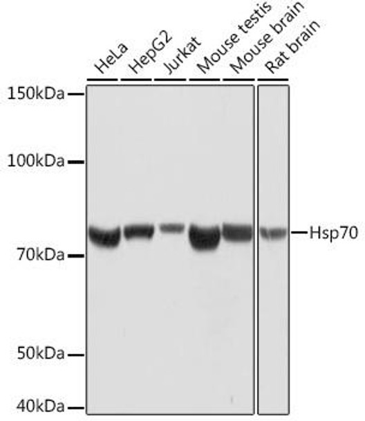 Hsp70 Rabbit Monoclonal Antibody (CAB4777)