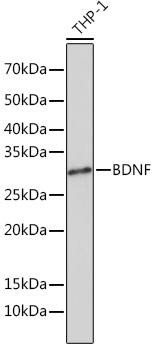 BDNF Rabbit Monoclonal Antibody (CAB4873)