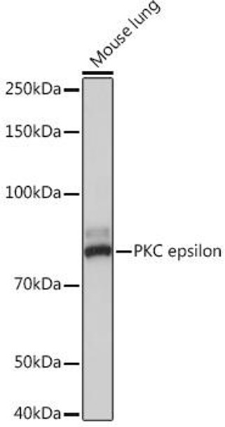 PKC epsilon Rabbit Monoclonal Antibody (CAB4998)
