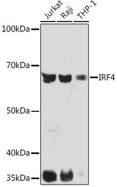IRF4 Rabbit Monoclonal Antibody (CAB5215)