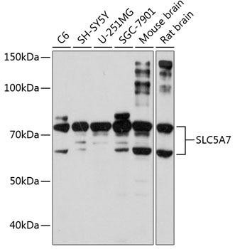 SLC5A7 Rabbit Polyclonal Antibody (CAB8247)
