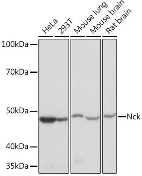 NCK1 Rabbit Monoclonal Antibody (CAB9129)