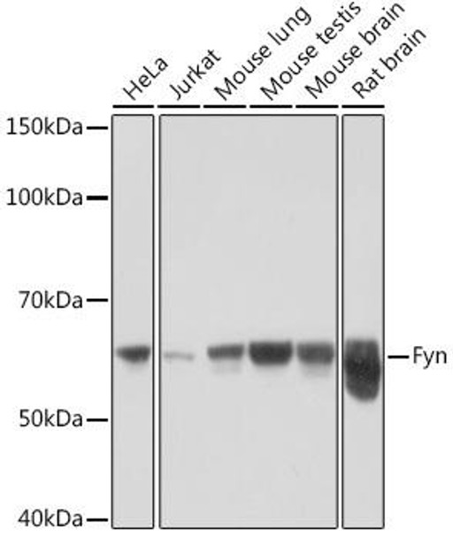 Fyn Rabbit Monoclonal Antibody (CAB9165)