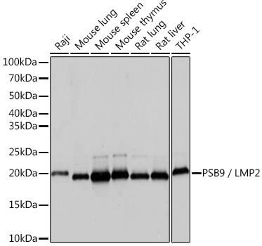 PSMB9/LMP2 Rabbit Monoclonal Antibody (CAB9549)