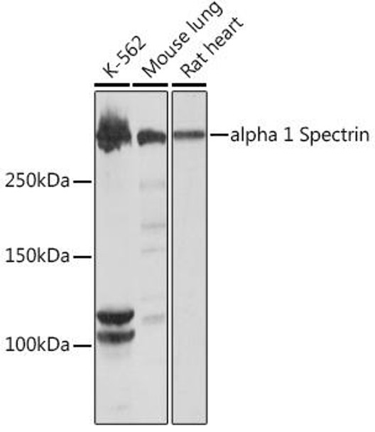 alpha 1 Spectrin Rabbit Monoclonal Antibody (CAB9597)