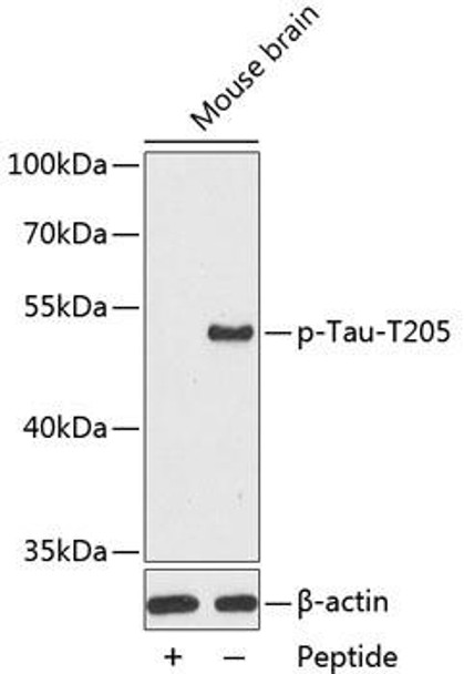 Phospho-Tau-T205 Rabbit Polyclonal Antibody (CABP0168)