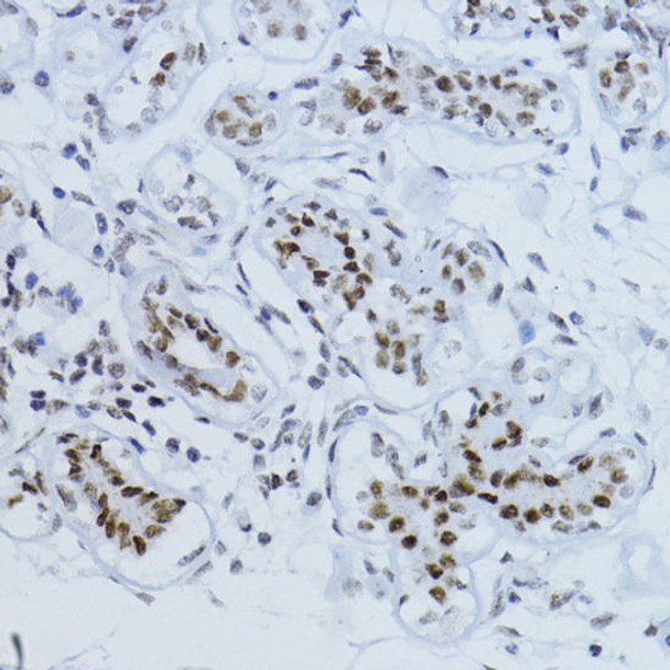 Phospho-Smad2-T220 Rabbit Polyclonal Antibody (CABP0909)