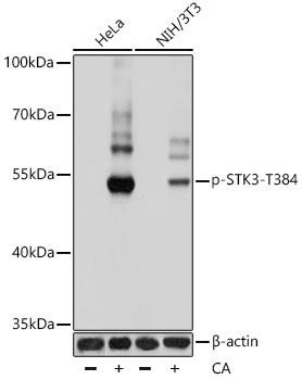 Phospho-STK3/MST2-T384 Rabbit Polyclonal Antibody (CABP0935)
