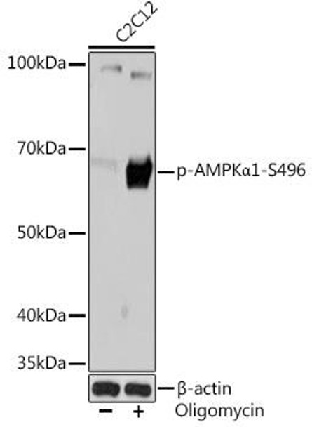Phospho-AMPKα1-S496 Rabbit Monoclonal Antibody (CABP1002)
