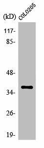OR52B2 Antibody (PACO01240)